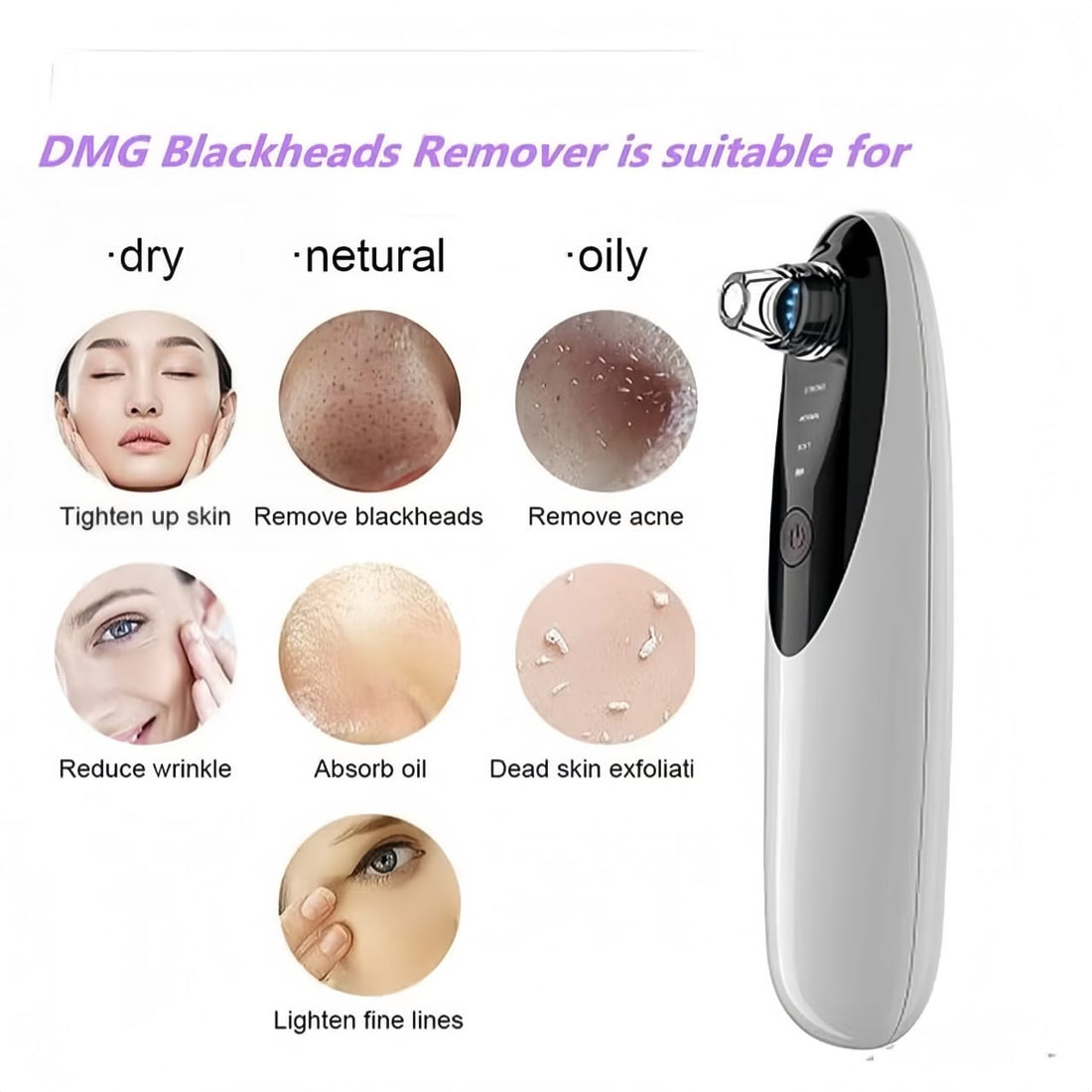 4-in-1 Facial Pore Vacuum – Blackhead Remover & Skin Cleaner